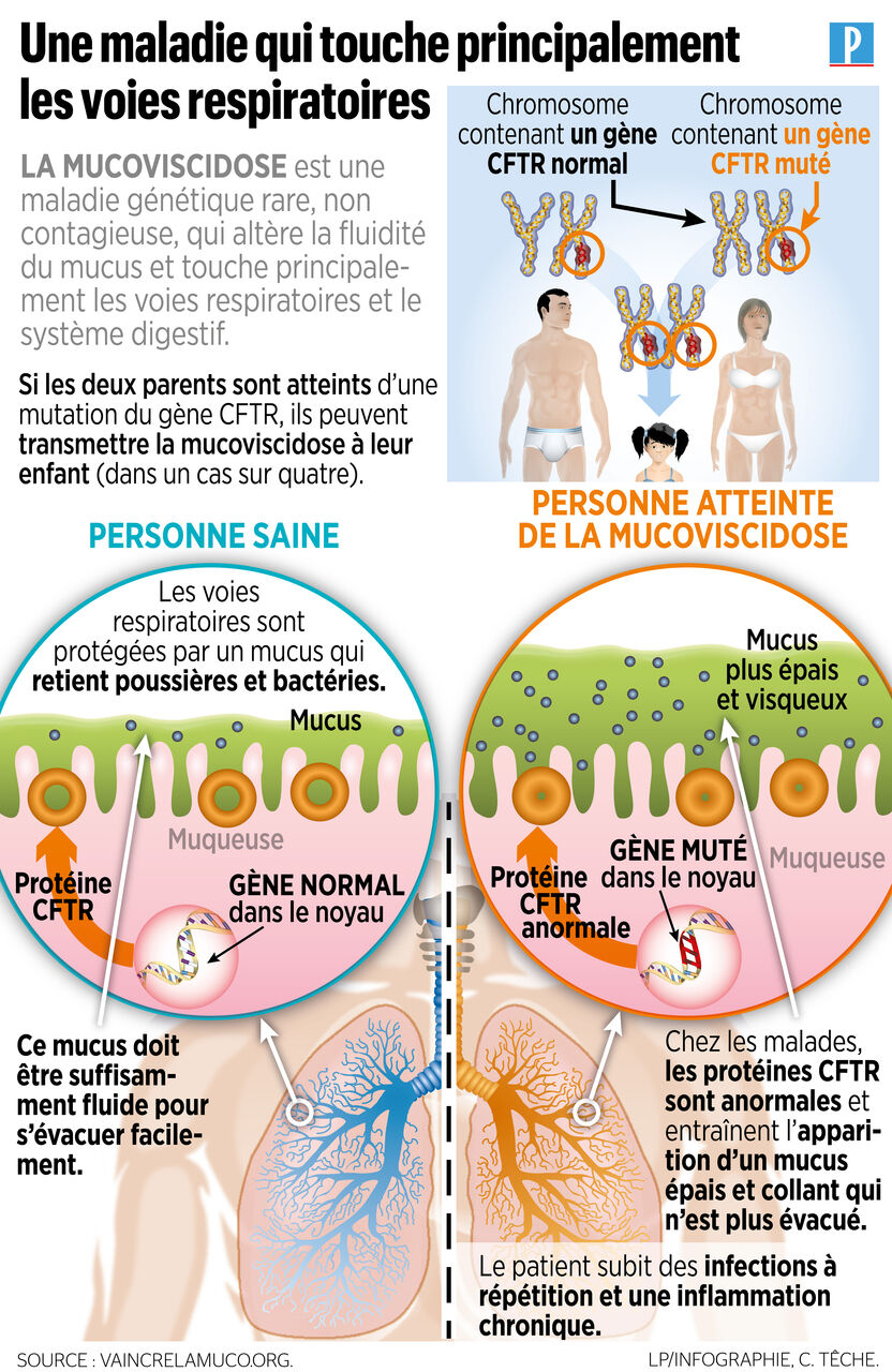 Progression dans la Lutte contre la Mucoviscidose